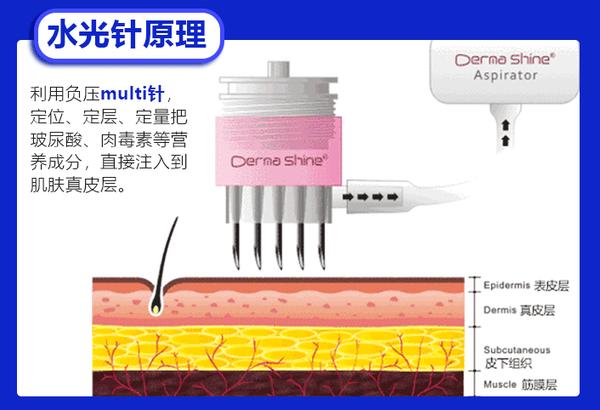 【水光针原理】人体的皮肤厚度是0.