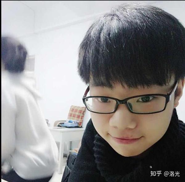 还是有明显的痕迹 以至于小时候的同学都叫我三瓣嘴