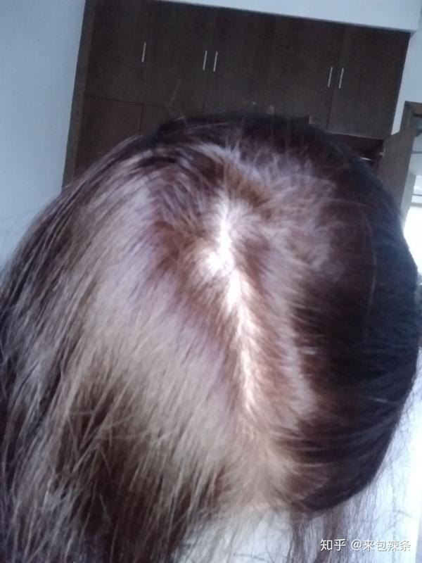 女生头发少是一种怎样的体验?