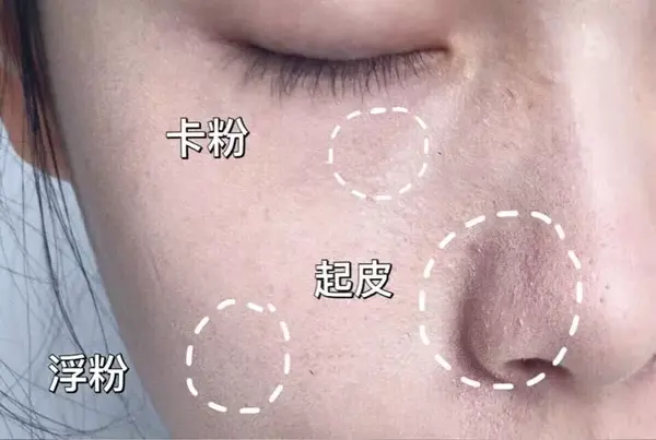用了滋润粉底还是各种干燥起皮?这些办法你试过了吗!