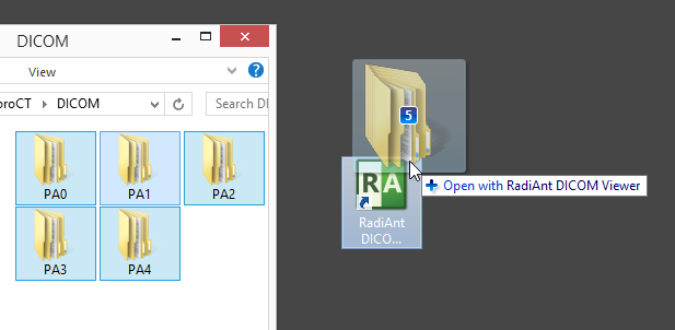 radiant专栏二如何从文件夹打开dicom