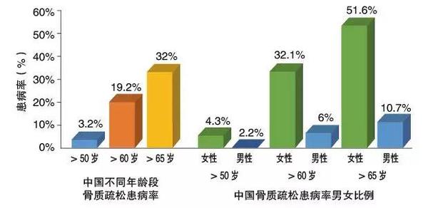 2003—2006年对50岁以上人群的椎体和股骨颈骨密度值进行了全国范围内