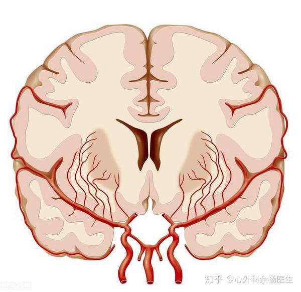 脑动脉硬化性痴呆_麻痹性痴呆愈后_血管性老年痴呆症