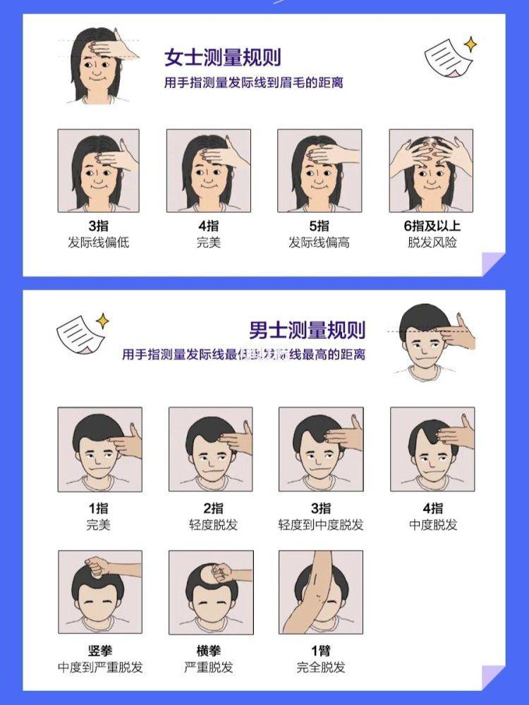 不懂就问 这样的发际线算高吗?