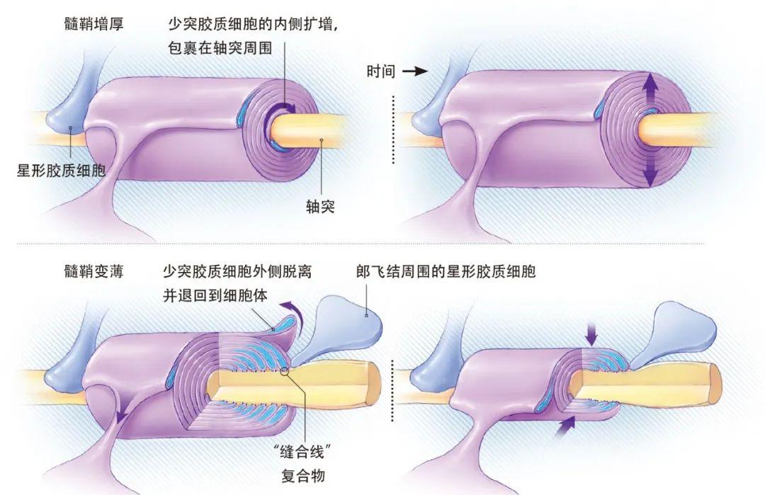 学霸和学渣的大脑有什么不同