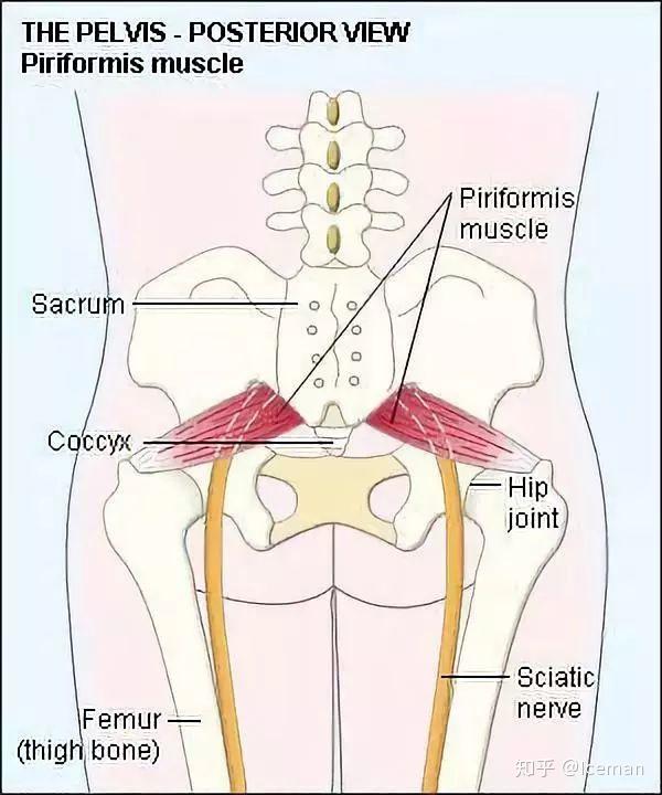 臀部疼痛,腰腿麻木不一定是"腰突"!你可能患有梨状肌综合征!