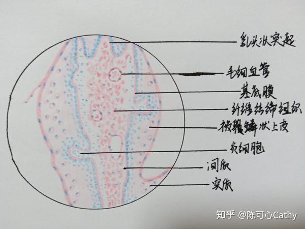 发完就清相册啦~ 有不妥的地方还希望大家指正  一,肝细胞水肿 最后