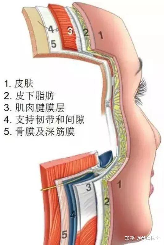 我们要到达的,是"肌肉层"(图中的3)——要穿过表皮层,真皮层,皮下组织