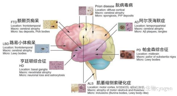 赛业神经科学云课堂第一期:无药可救的神经退行性疾病