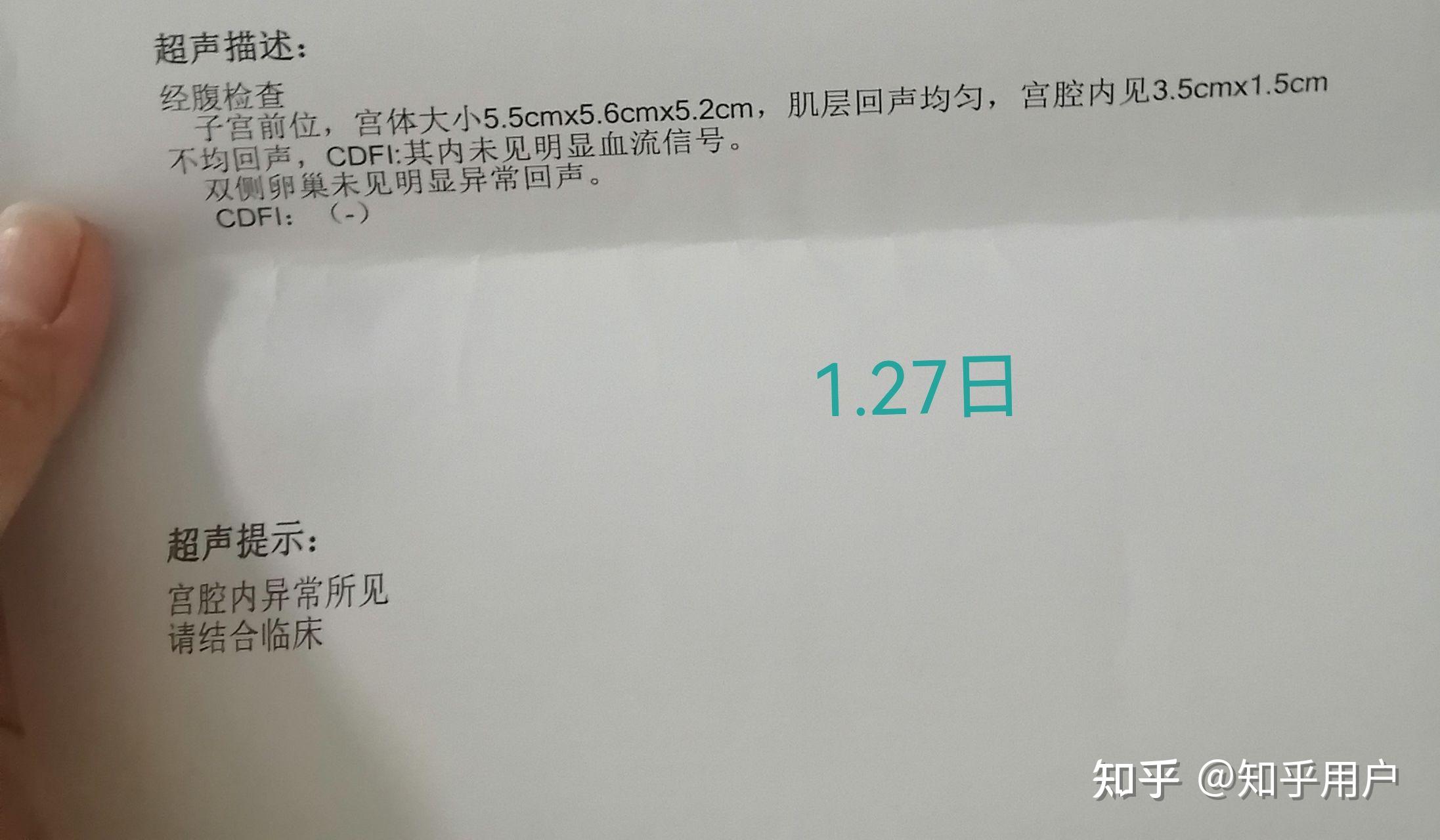 21 条评论默认时间代表月亮消灭你16天复查,4厘米残留,hcg273,医生让