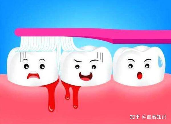 【疾病判断】总是牙龈出血,是得了血液病吗?