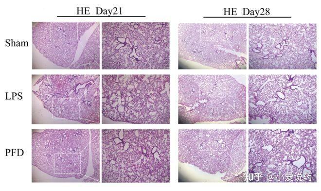 小鼠肺纤维化模型 肺纤维化模型 动物模型的建立 动物模型构建 知乎
