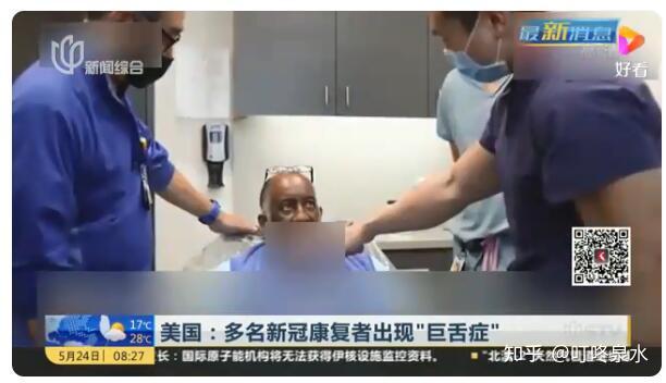 美国新冠康复者出现巨舌症 这是咋情况?