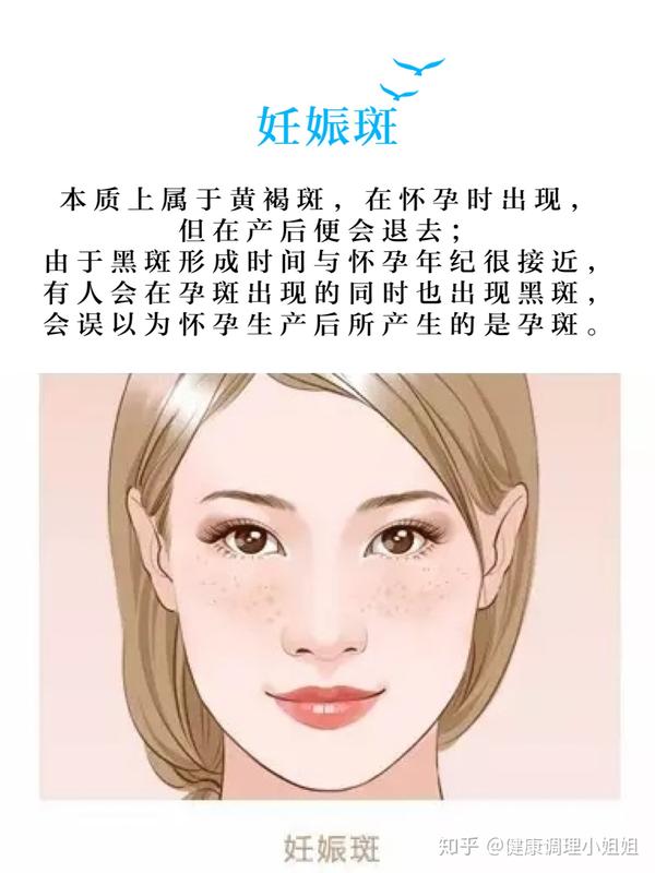 色斑种类多,你是哪种斑?先辨别再祛斑,有效更靠谱!
