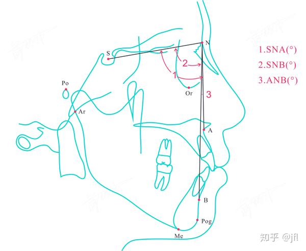 头影测量——华西分析法