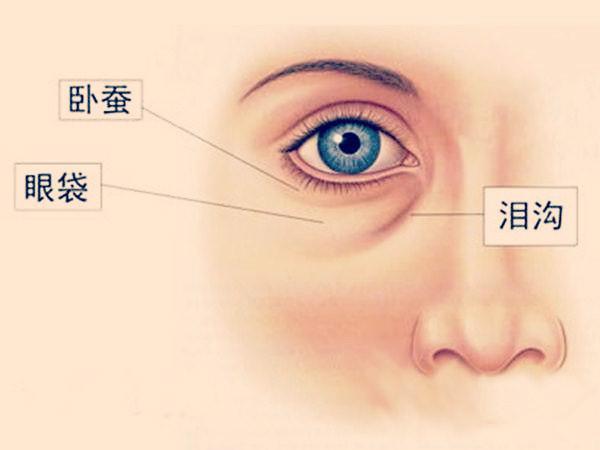 下眼袋手术是怎么回事丨眼部整形系列科普第十一篇