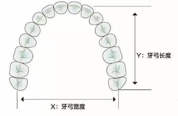 牙齿矫正什么是扩弓会让脸型变大吗