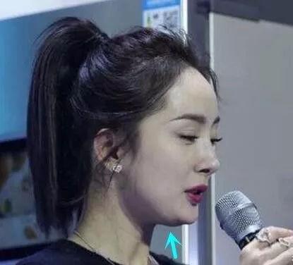 北京磨骨大盘点小白攻略