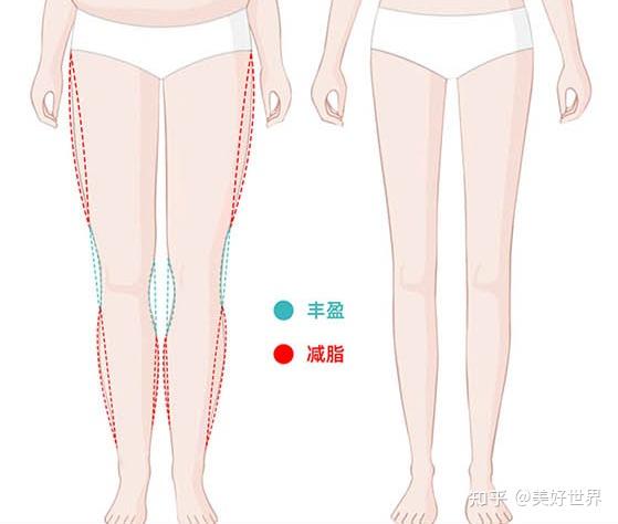 樱桃医美齐永乐瘦腿指南,什么是平行直腿术,如何打造直腿?
