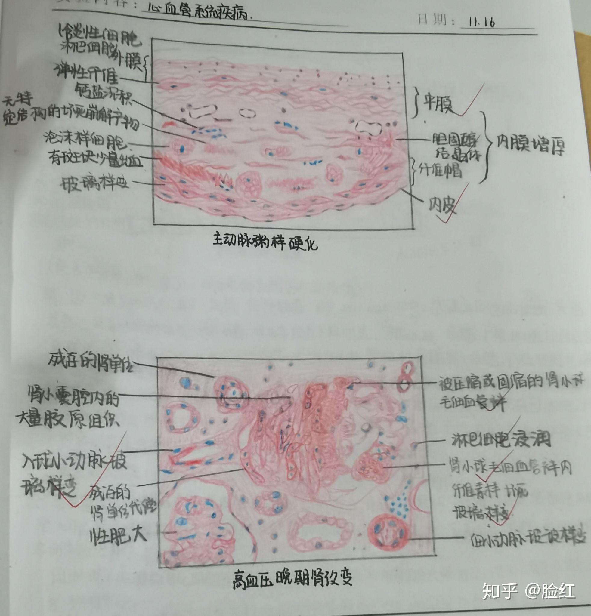 病理学红蓝铅笔绘图