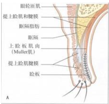 割双眼皮对外貌的改变大吗