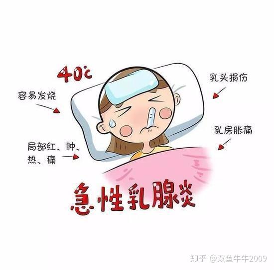 哺乳期乳汁淤积病例分享