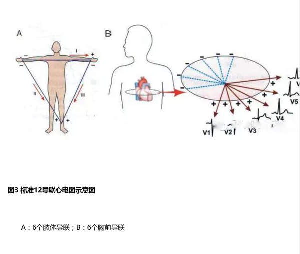 标准12导联心电图最终得以完善.