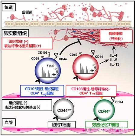 日本医学快讯|日本明确导致肺部组织纤维化的新细胞群,或是治疗霉菌性