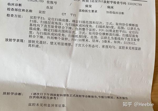 9 盆腔ct