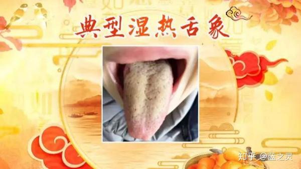 阳虚,气虚,湿热体质怎么调?三种体质自测,一对一防治疾病