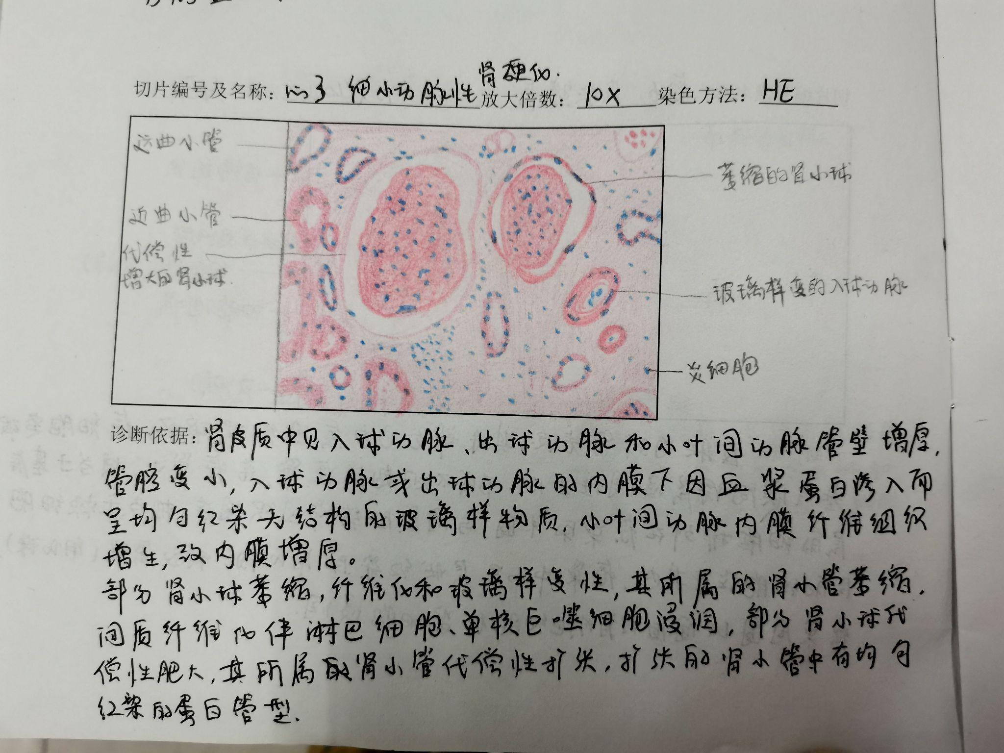 病理学实验报告红蓝铅笔手绘图