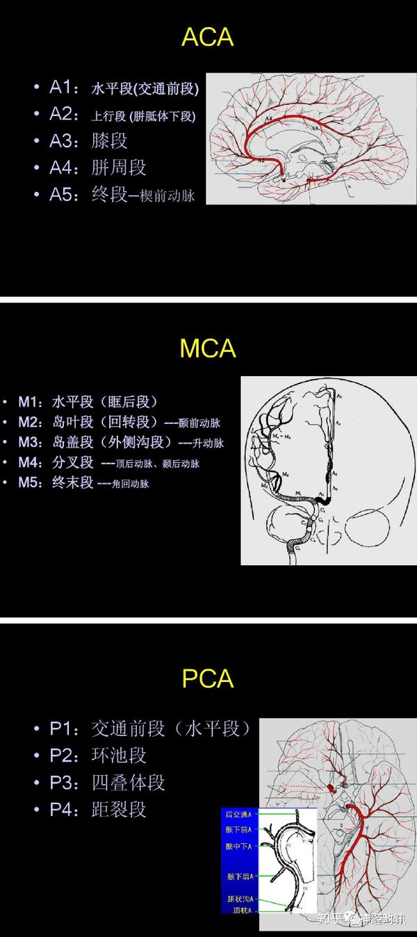 大脑前动脉 aca,大脑中动脉 mca,大脑后动脉 pca,前交通动脉 acoa,后