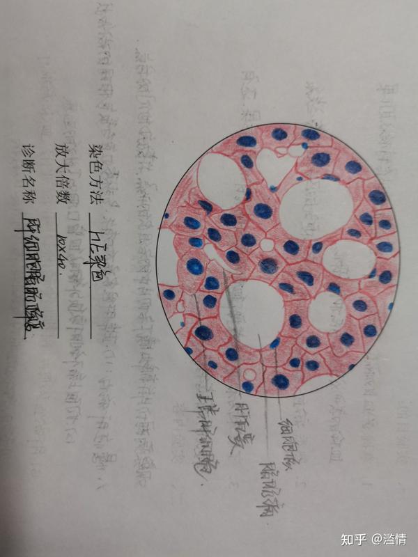 病理学组织切片红蓝铅手绘图