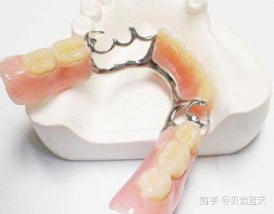 2.活动假牙