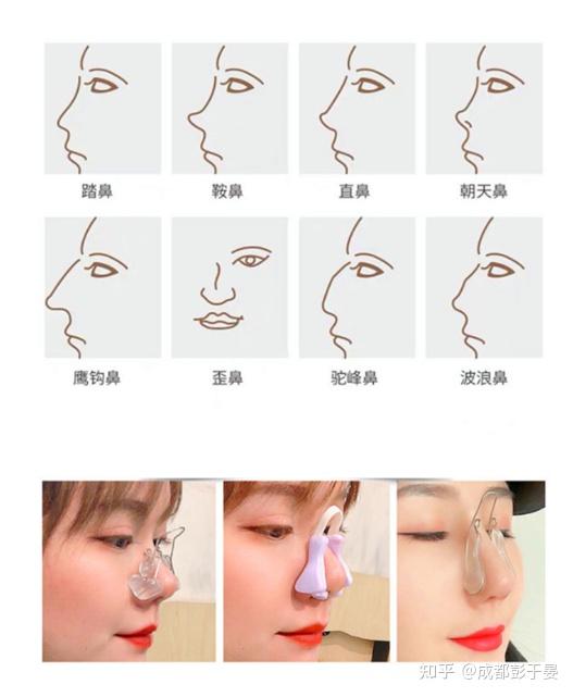 如何矫正鼻型,塑造完美鼻子