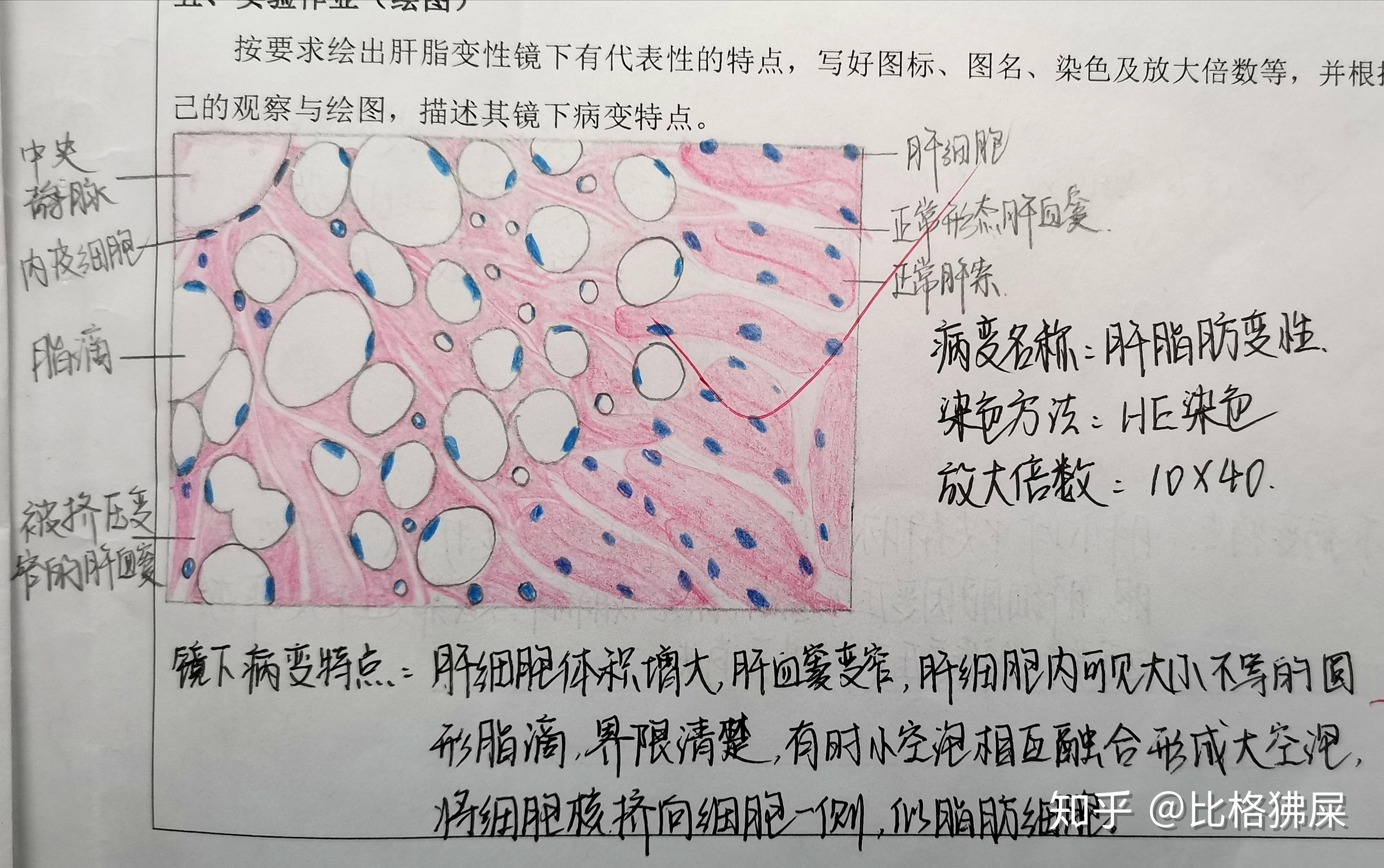 病理学实验红蓝铅笔图