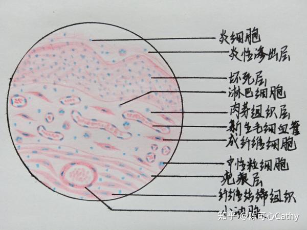 病理学红蓝铅笔绘图 实验作业