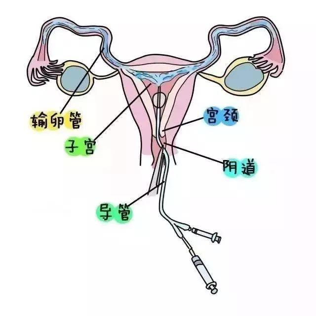 02 卵泡多大排出最易受孕