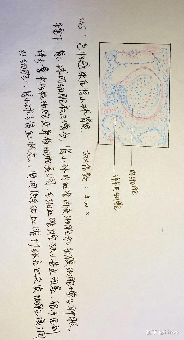 病理学切片红蓝铅手绘图