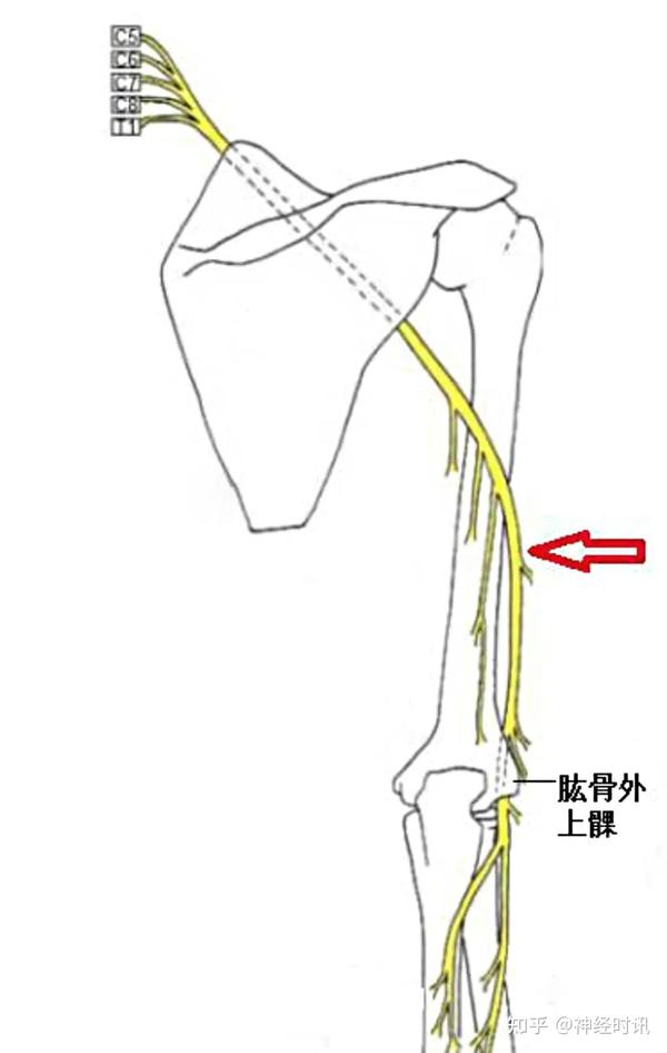 桡神经沟部:上臂的外侧,桡神经从后转向外侧部位,在此段桡神经位于