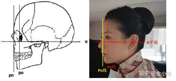 首先我们看一个标准侧面,以面部发育规整的董洁为例,下巴位置不偏不倚