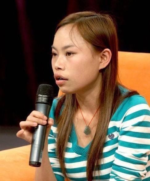 美学揭秘丨从凤姐的脸说起为什么嘴突的人普遍都不好看