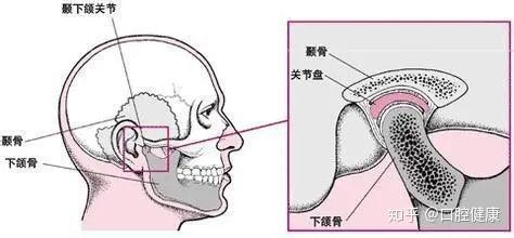 颞下颌关节紊乱