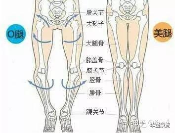 遗传:父母有"八字脚"的遗传给孩子概率极高; 子宫内发育不良:特殊胎位