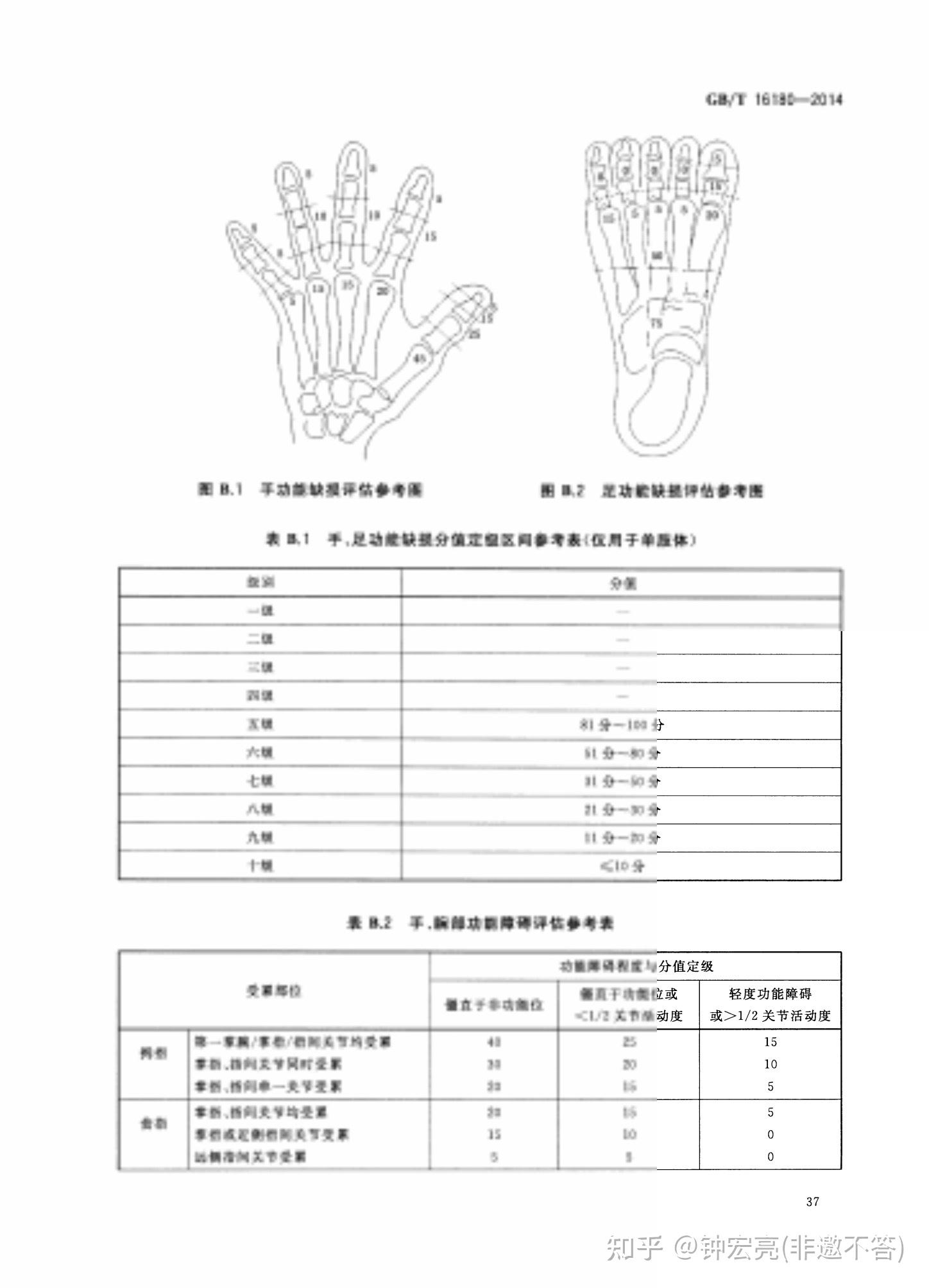 手腕三处骨折算几级工伤?