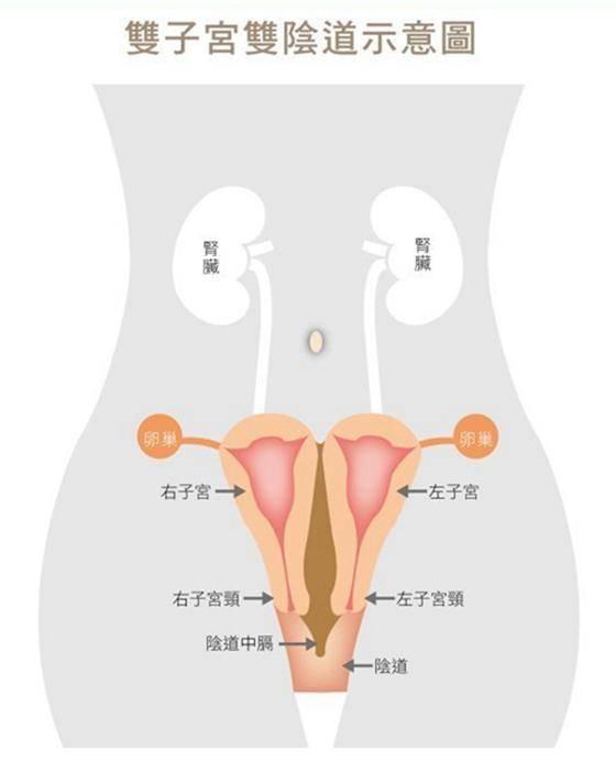 天呐原来子宫会变形