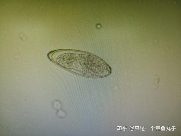 绦虫 曼氏迭宫绦虫