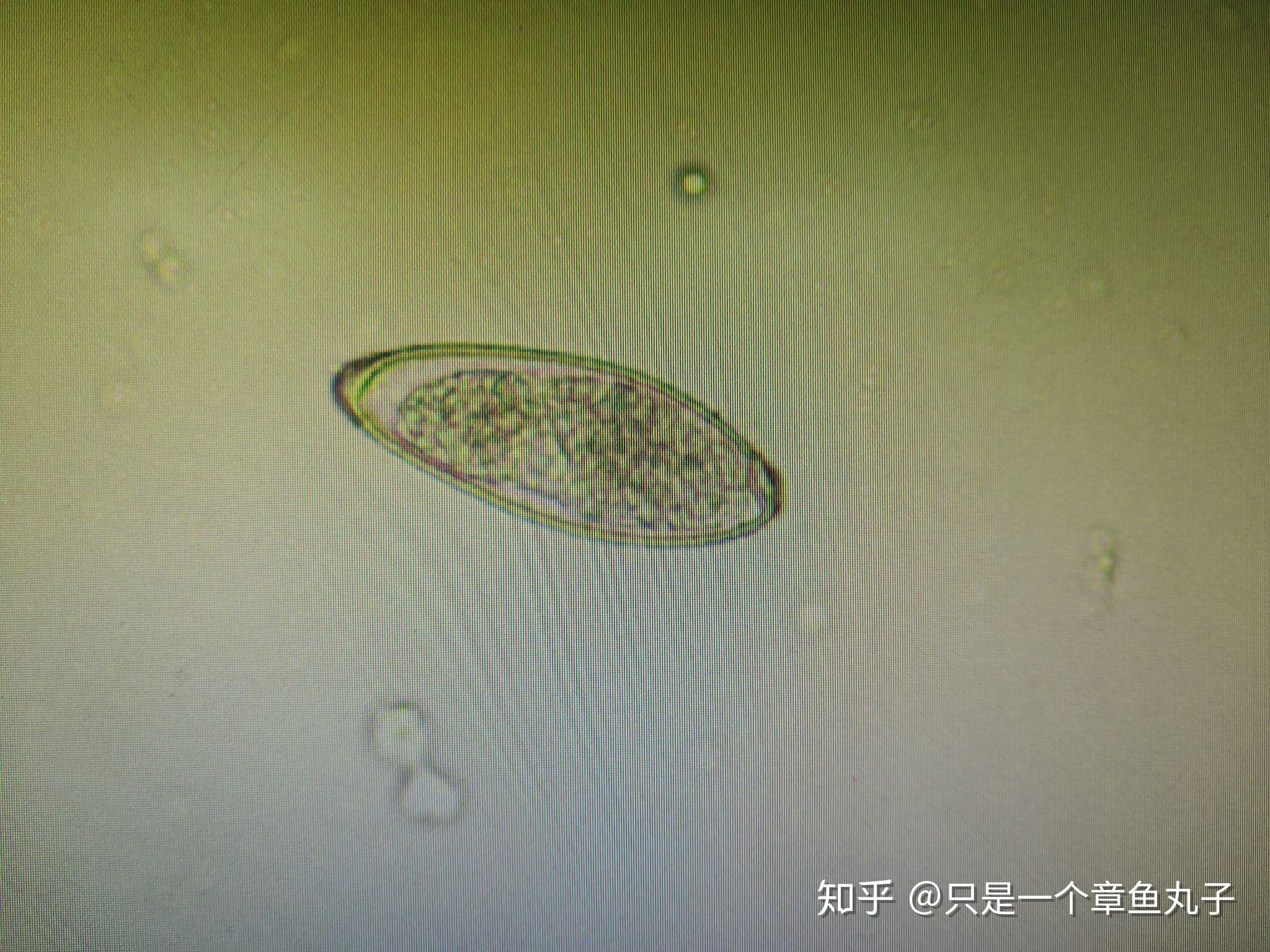 曼氏迭宫绦虫绦虫血吸虫布氏姜片吸虫(姜片虫)并殖吸虫(肺吸虫)华支睾