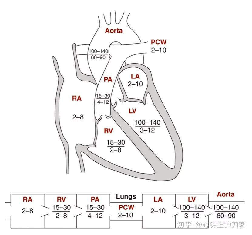 右心导管检查 知乎