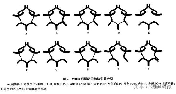 Willis环丨超细解剖 超全变异 知乎